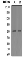 CSPG5 / Neuroglycan C Antibody - Western blot analysis of Neuroglycan C expression in THP1 (A); Raw264.7 (B) whole cell lysates.