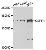 CSPP1 Antibody - Western blot analysis of extracts of various cells.