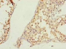 CSPP1 Antibody - Immunohistochemistry of paraffin-embedded human testis tissue at dilution of 1:100