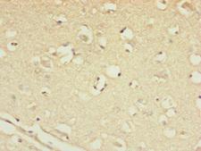 CSPP1 Antibody - Immunohistochemistry of paraffin-embedded human brain tissue at dilution of 1:100
