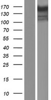 CSPP1 Protein - Western validation with an anti-DDK antibody * L: Control HEK293 lysate R: Over-expression lysate