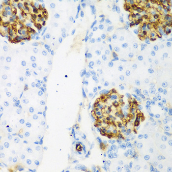 CSRNP1 / AXUD1 Antibody - Immunohistochemistry of paraffin-embedded rat kidney tissue.