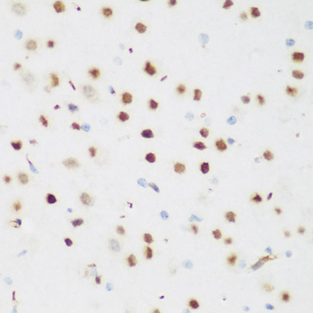 CSRNP1 / AXUD1 Antibody - Immunohistochemistry of paraffin-embedded mouse brain tissue.