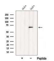 CSRNP1 / AXUD1 Antibody - Western blot analysis of extracts of HeLa cells using AXUD1 antibody. The lane on the left was treated with blocking peptide.