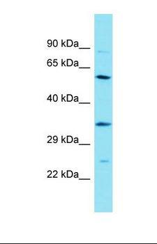 CSRNP2 / FAM130A1 Antibody - Western blot of RPMI-8226. DBF4B antibody dilution 1.0 ug/ml.  This image was taken for the unconjugated form of this product. Other forms have not been tested.