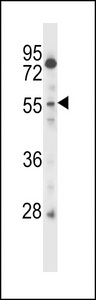 CSRNP2 / FAM130A1 Antibody - CSRNP2 Antibody western blot of CEM cell line lysates (35 ug/lane). The CSRNP2 antibody detected the CSRNP2 protein (arrow).
