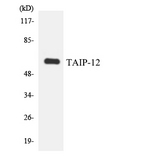 CSRNP2 / FAM130A1 Antibody - Western blot analysis of the lysates from 293 cells using TAIP-12 antibody.