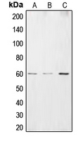 CSRNP2 / FAM130A1 Antibody - Western blot analysis of CSRNP2 expression in HEK293T (A); HepG2 (B); HUVEC (C) whole cell lysates.