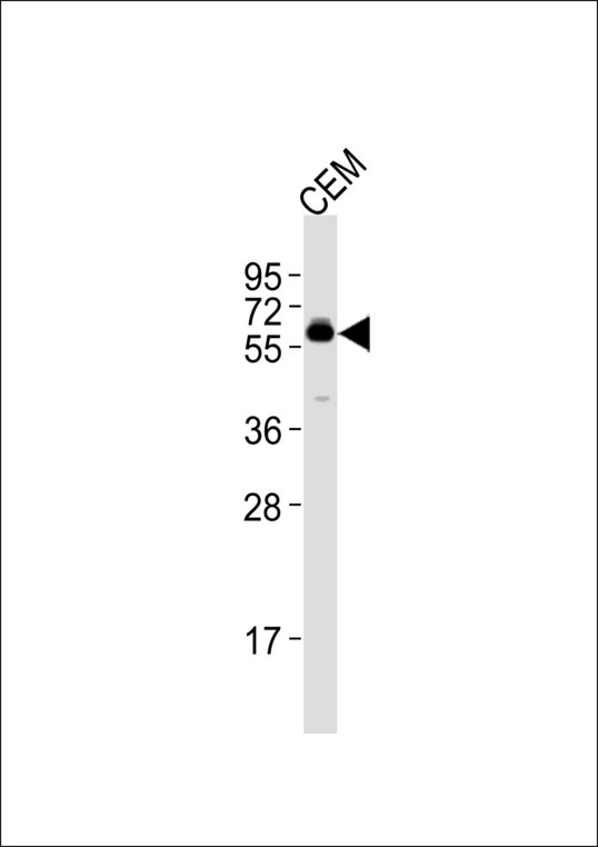 CSRNP2 / FAM130A1 Antibody - Anti-CSRNP2 Antibody at 1:1000 dilution + CEM whole cell lysates Lysates/proteins at 20 ug per lane. Secondary Goat Anti-Rabbit IgG, (H+L),Peroxidase conjugated at 1/10000 dilution Predicted band size : 60 kDa Blocking/Dilution buffer: 5% NFDM/TBST.