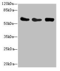 CSRNP2 / FAM130A1 Antibody - Western blot All lanes: CSRNP2 antibody at 2.71µg/ml Lane 1: Mouse heart tissue Lane 2: HepG2 whole cell lysate Lane 3: Mouse brain tissue Secondary Goat polyclonal to rabbit IgG at 1/10000 dilution Predicted band size: 60 kDa Observed band size: 60 kDa