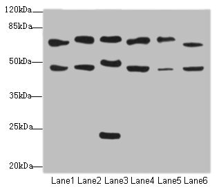 CSRNP2 / FAM130A1 Antibody - Western blot All Lanes: CSRNP2antibody at 2.34ug/ml Lane 1: Mouse liver tissue Lane 2: Mouse heart tissue Lane 3: Mouse lung tissue Lane 4: Mouse kidney tissue Lane 5: HepG-2 whole cell lysate Lane 6: Mouse brain tissue Secondary Goat polyclonal to Rabbit IgG at 1/10000 dilution Predicted band size: 60 kDa Observed band size: 60 kDa,48 kDa,24 kDa