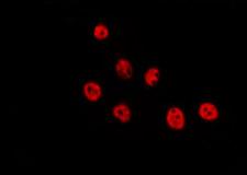 CSRNP2 / FAM130A1 Antibody - Staining HepG2 cells by IF/ICC. The samples were fixed with PFA and permeabilized in 0.1% Triton X-100, then blocked in 10% serum for 45 min at 25°C. The primary antibody was diluted at 1:200 and incubated with the sample for 1 hour at 37°C. An Alexa Fluor 594 conjugated goat anti-rabbit IgG (H+L) Ab, diluted at 1/600, was used as the secondary antibody.