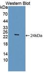 CSRP1 Antibody - Western blot of CSRP1 antibody.