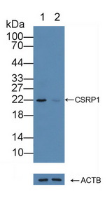 CSRP1 Antibody - Knockout Varification: Lane 1: Wild-type Hela cell lysate; Lane 2: CSRP1 knockout Hela cell lysate; Predicted MW: 21kd Observed MW: 22kd Primary Ab: 1µg/ml Rabbit Anti-Human CSRP1 Antibody Second Ab: 0.2µg/mL HRP-Linked Caprine Anti-Rabbit IgG Polyclonal Antibody