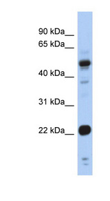 CSRP1 Antibody - CSRP1 antibody Western blot of Fetal Stomach lysate. This image was taken for the unconjugated form of this product. Other forms have not been tested.