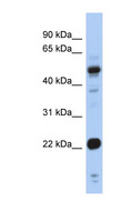 CSRP1 Antibody - CSRP1 antibody Western blot of Fetal Stomach lysate. This image was taken for the unconjugated form of this product. Other forms have not been tested.