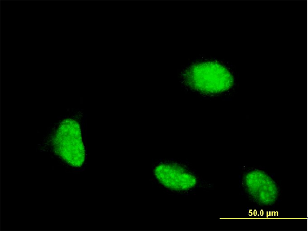 CSRP1 Antibody - Immunofluorescence of monoclonal antibody to CSRP1 on HeLa cell . [antibody concentration 10 ug/ml]