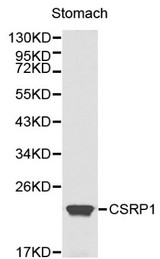 CSRP1 Antibody - Western blot of CSRP1 pAb in extracts from mouse stomach tissue.
