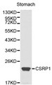 CSRP1 Antibody - Western blot of CSRP1 pAb in extracts from mouse stomach tissue.