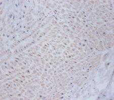 CSRP1 Antibody - Immunohistochemistry of paraffin-embedded human umbilical cord tissue using CSRP1 Antibody at dilution of 1:100