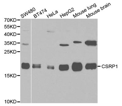 CSRP1 Antibody - Western blot analysis of various cell lines.