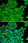 CSRP1 Antibody - Immunofluorescence analysis of HeLa cells.