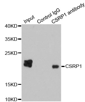 CSRP1 Antibody - Immunoprecipitation analysis of 200ug extracts of HepG2 cells using 1ug CSRP1 antibody. Western blot was performed from the immunoprecipitate using CSRP1 antibodyat a dilition of 1:1000.