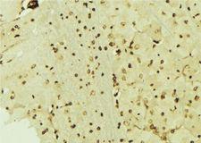 CSRP1 Antibody - 1:100 staining mouse brain tissue by IHC-P. The sample was formaldehyde fixed and a heat mediated antigen retrieval step in citrate buffer was performed. The sample was then blocked and incubated with the antibody for 1.5 hours at 22°C. An HRP conjugated goat anti-rabbit antibody was used as the secondary.