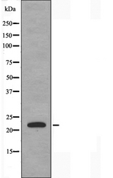CSRP1 Antibody - Western blot analysis of extracts of HeLa cells using CRP1 antibody.