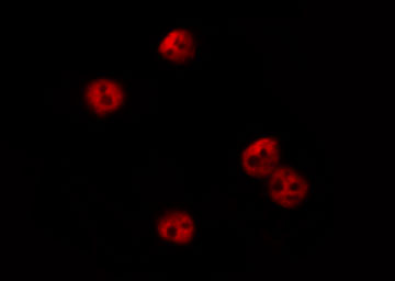 CSRP1 Antibody - Staining HeLa cells by IF/ICC. The samples were fixed with PFA and permeabilized in 0.1% Triton X-100, then blocked in 10% serum for 45 min at 25°C. The primary antibody was diluted at 1:200 and incubated with the sample for 1 hour at 37°C. An Alexa Fluor 594 conjugated goat anti-rabbit IgG (H+L) Ab, diluted at 1/600, was used as the secondary antibody.