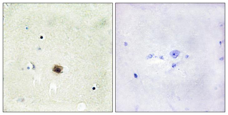 CSRP1 Antibody - Peptide - + Immunohistochemistry analysis of paraffin-embedded human brain tissue using CRP1 antibody.