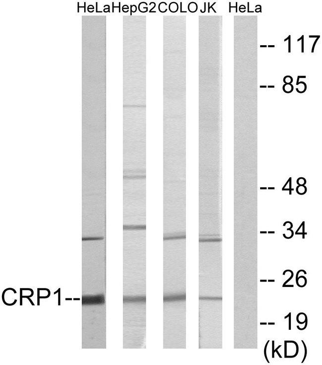 CSRP1 Antibody - Western blot analysis of extracts from HeLa, HepG2 cells, COLO cells and Jurkat cells, using CRP1 antibody.