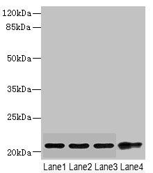 CSRP2 Antibody - Western blot All lanes: CSRP2 antibody at 5.74µg/ml Lane 1: Mouse lung tissue Lane 2: A375 whole cell lysate Lane 3: A549 whole cell lysate Lane 4: HepG2 whole cell lysate Secondary Goat polyclonal to rabbit IgG at 1/10000 dilution Predicted band size: 21 kDa Observed band size: 21 kDa