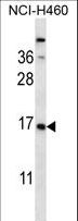CSRP2 Antibody - CSRP2 Antibody western blot of NCI-H460 cell line lysates (35 ug/lane). The CSRP2 antibody detected the CSRP2 protein (arrow).