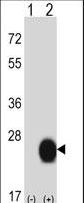 CSRP2 Antibody - Western blot of CSRP2 (arrow) using rabbit polyclonal CSRP2 Antibody. 293 cell lysates (2 ug/lane) either nontransfected (Lane 1) or transiently transfected (Lane 2) with the CSRP2 gene.