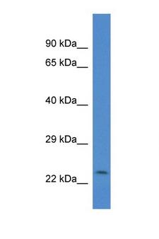 CSRP2 Antibody - CSRP2 antibody Western blot of Mouse Pancreas lysate. Antibody concentration 1 ug/ml. This image was taken for the unconjugated form of this product. Other forms have not been tested.