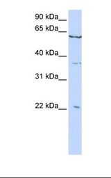 CSRP2 Antibody - HepG2 cell lysate. Antibody concentration: 1.0 ug/ml. Gel concentration: 12%.  This image was taken for the unconjugated form of this product. Other forms have not been tested.