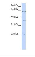 CSRP2 Antibody - HepG2 cell lysate. Antibody concentration: 1.0 ug/ml. Gel concentration: 12%.  This image was taken for the unconjugated form of this product. Other forms have not been tested.