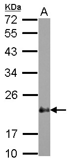 CSRP2 Antibody - Sample (30 ug of whole cell lysate) A: HeLa 12% SDS PAGE CSRP2 antibody diluted at 1:1000