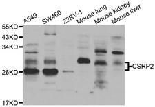 CSRP2 Antibody - Western blot analysis of extracts of various cell lines.