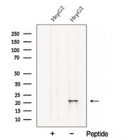CSRP2 Antibody - Western blot analysis of extracts of HepG2 cells using CSRP2 antibody. The lane on the left was treated with blocking peptide.