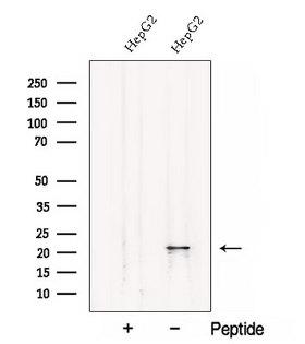 CSRP2 Antibody - Western blot analysis of extracts of HepG2 cells using CSRP2 antibody. The lane on the left was treated with blocking peptide.
