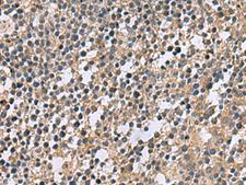 CSRP2 Antibody - Immunohistochemistry of paraffin-embedded Human tonsil tissue  using CSRP2 Polyclonal Antibody at dilution of 1:60(×200)