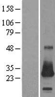 CSRP2 Protein - Western validation with an anti-DDK antibody * L: Control HEK293 lysate R: Over-expression lysate