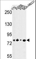 CSRP2BP Antibody - Western blot of CSRP2BP Antibody in Y79, A2058, A375, MDA-MB231 cell line lysates (35 ug/lane). CSRP2BP (arrow) was detected using the purified antibody.
