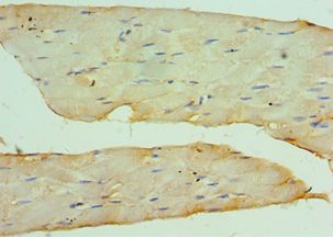 CSRP2BP Antibody - Immunohistochemistry of paraffin-embedded human skeletal muscle using antibody at 1:100 dilution.
