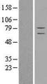 CSRP2BP Protein - Western validation with an anti-DDK antibody * L: Control HEK293 lysate R: Over-expression lysate