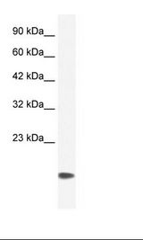 CSRP3 Antibody - Jurkat Cell Lysate.  This image was taken for the unconjugated form of this product. Other forms have not been tested.