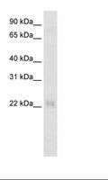 CSRP3 Antibody - Fetal Heart Lysate.  This image was taken for the unconjugated form of this product. Other forms have not been tested.
