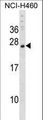 CSRP3 Antibody - CSRP3 Antibody western blot of NCI-H460 cell line lysates (35 ug/lane). The CSRP3 antibody detected the CSRP3 protein (arrow).